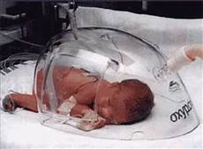 Oxygen Hood